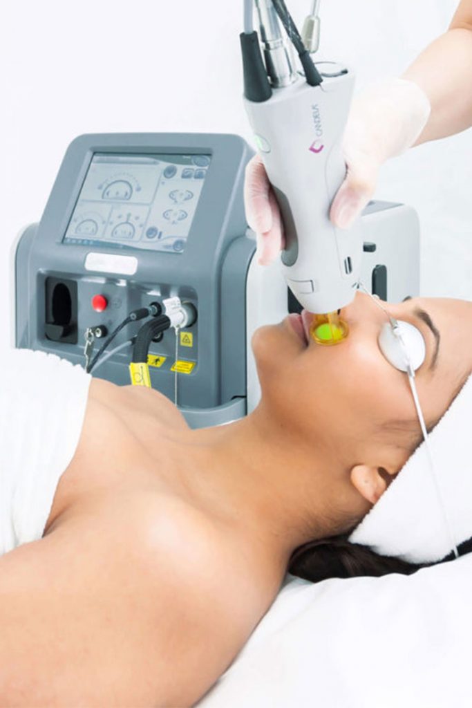 GentleMax Pro North York Dermatology Clinic