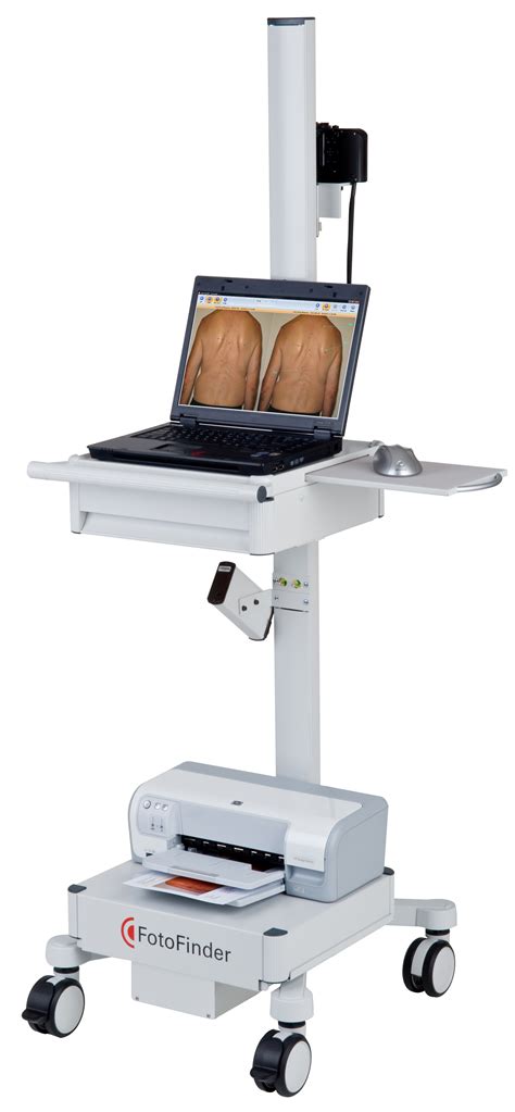 Mole Mapping – North York Dermatology Clinic